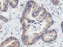 LCMT1 Mouse anti-Human, Clone: OTI4A5, lyophilized, TrueMAB 100 &mu;g;
