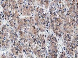 LCMT1 Mouse anti-Human, Clone: OTI4A5, lyophilized, TrueMAB 100 &mu;g;
