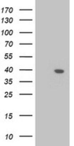LCMT1 Mouse anti-Human, Clone: OTI1E7, lyophilized, TrueMAB 100 &mu;g;