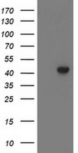 LCMT1 Monoclonal Antibody (OTI3F4), TrueMAB , OriGene 30 &mu;L; Unconjugated:Antibodies,