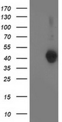 LCMT1 Mouse anti-Human, Clone: OTI 1G5, liquid, TrueMAB 100 &mu;L; Unconjugated:Antibodies,