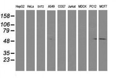 LCMT1 Mouse anti-Human, Clone: OTI 1G5, liquid, TrueMAB 100 &mu;L; Unconjugated:Antibodies,