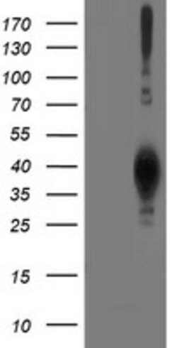 LCMT1 Mouse anti-Human, Clone: OTI4A5, lyophilized, TrueMAB 100 &mu;g;