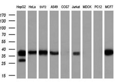 LCMT1 Mouse anti-Human, Clone: OTI4A5, lyophilized, TrueMAB 100 &mu;g;