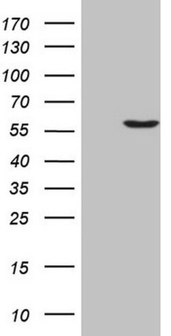LCOR Monoclonal Antibody (OTI2A9), TrueMAB , OriGene 100 &mu;L; Unconjugated:Anticuerpos