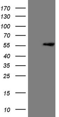 LCOR Monoclonal Antibody (OTI4G8), TrueMAB , OriGene:Antibodies:Primary