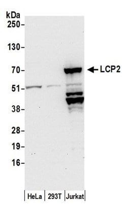 LCP2/SLP76 Polyclonal Antibody, Bethyl Laboratories 20 &mu;L | Buy Online | Bethyl Laboratories, Inc | Fisher Scientific