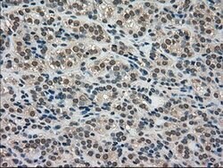 LDHA Mouse anti-Human, Clone: OTI2C11, lyophilized, TrueMAB 100 &mu;g;