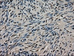 LDHA Mouse anti-Human, Clone: OTI2C11, lyophilized, TrueMAB 100 &mu;g;
