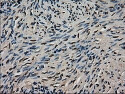 LDHA Mouse anti-Human, Clone: OTI2C11, liquid, TrueMAB 100 &mu;L; Unconjugated:Antibodies,