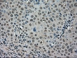 LDHA Mouse anti-Human, Clone: OTI2C11, lyophilized, TrueMAB 100 &mu;g;