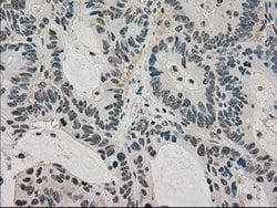 LDHA Mouse anti-Human, Clone: OTI2C11, lyophilized, TrueMAB 100 &mu;g;