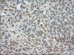 LDHA Mouse anti-Human, Clone: OTI2B11, lyophilized, TrueMAB 100 &mu;g | Buy Online | OriGene | Fisher Scientific