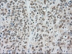 LDHA Mouse anti-Human, Clone: OTI2B11, lyophilized, TrueMAB 100 &mu;g | Buy Online | OriGene | Fisher Scientific