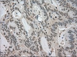 LDHA Mouse anti-Human, Clone: OTI2B11, lyophilized, TrueMAB 100 &mu;g | Buy Online | OriGene | Fisher Scientific