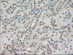 LDHA Mouse anti-Human, Clone: OTI2B11, lyophilized, TrueMAB 100 &mu;g | Buy Online | OriGene | Fisher Scientific