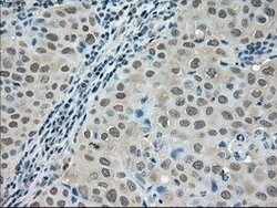 LDHA Mouse anti-Human, Clone: OTI5G10, lyophilized, TrueMAB 100 &mu;g;