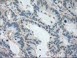 LDHA Mouse anti-Human, Clone: OTI5G10, lyophilized, TrueMAB 100 &mu;g;