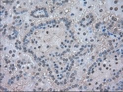 LDHA Mouse anti-Human, Clone: OTI5G10, lyophilized, TrueMAB 100 &mu;g;