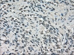 LDHA Mouse anti-Human, Clone: OTI2D11, lyophilized, TrueMAB 100 &mu;g;