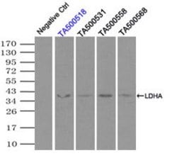LDHA Mouse anti-Human, Clone: OTI2C11, lyophilized, TrueMAB 100 &mu;g;