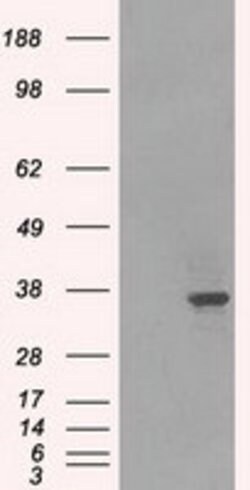 LDHA Mouse anti-Human, Clone: OTI2B11, lyophilized, TrueMAB 100 &mu;g | Buy Online | OriGene | Fisher Scientific