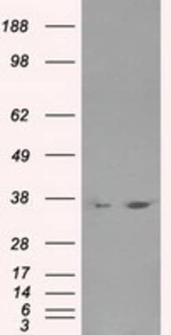 LDHA Mouse anti-Human, Clone: OTI5G10, lyophilized, TrueMAB 100 &mu;g;