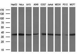 LDHA Mouse anti-Human, Clone: OTI2D11, lyophilized, TrueMAB 100 &mu;g;
