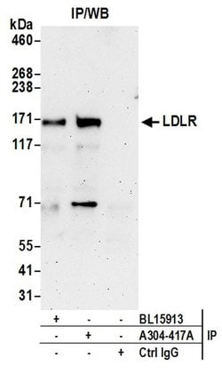 LDLR Rabbit anti-Human, Polyclonal, Bethyl Laboratories 100 &mu;L; Unconjugated:Antibodies,