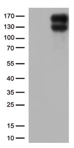 LDLR Monoclonal Antibody (OTI4E9), TrueMAB , OriGene:Antibodies:Primary