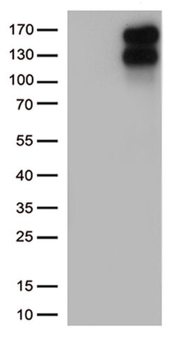 LDLR Monoclonal Antibody (OTI8D12), TrueMAB , OriGene:Antibodies:Primary