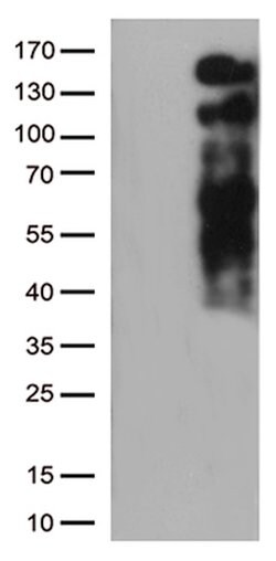LDLR Mouse anti-Human, Clone: OTI7C5, lyophilized, TrueMAB 100 &mu;g; Unconjugated:Antibodies,