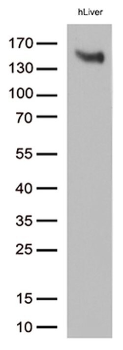 LDLR Mouse anti-Human, Clone: OTI7C5, lyophilized, TrueMAB 100 &mu;g; Unconjugated:Antibodies,