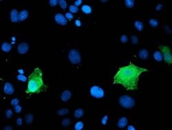 LDLRAP1 Monoclonal Antibody (OTI5A12), TrueMAB , OriGene 100 &mu;L; Unconjugated:Antibodies,