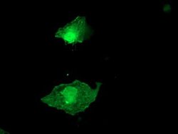 LDLRAP1 Monoclonal Antibody (OTI4G5), TrueMAB , OriGene:Antibodies:Primary