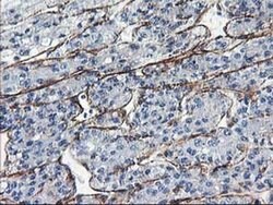 LDLRAP1 Monoclonal Antibody (OTI4B10), TrueMAB , OriGene 100 &mu;L; Unconjugated:Antibodies,