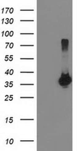 LDLRAP1 Monoclonal Antibody (OTI2B2), TrueMAB , OriGene 30 &mu;L; Unconjugated:Antibodies,