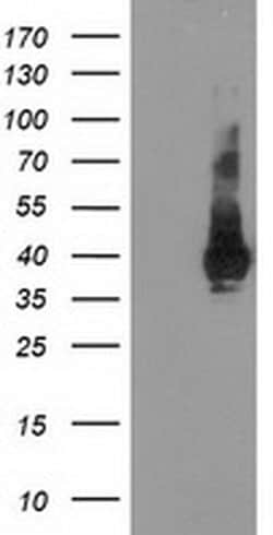 LDLRAP1 Monoclonal Antibody (OTI7G2), TrueMAB , OriGene 100 &mu;L; Unconjugated:Antibodies,