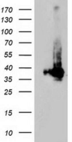 LDLRAP1 Mouse anti-Human, Clone: OTI4B10, lyophilized, TrueMAB 100 &mu;g;