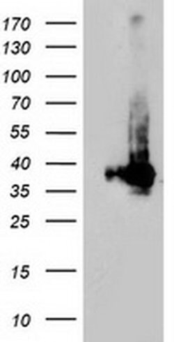 LDLRAP1 Monoclonal Antibody (OTI4B10), TrueMAB , OriGene 100 &mu;L; Unconjugated:Antibodies,