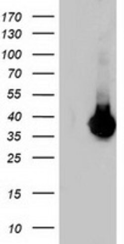 LDLRAP1 Mouse anti-Human, Clone: OTI5A12, lyophilized, TrueMAB 100 &mu;g;