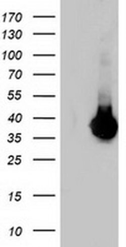 LDLRAP1 Monoclonal Antibody (OTI5A12), TrueMAB , OriGene 100 &mu;L; Unconjugated:Antibodies,