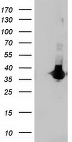 LDLRAP1 Monoclonal Antibody (OTI7H10), TrueMAB , OriGene 30 &mu;L; Unconjugated:Antibodies,