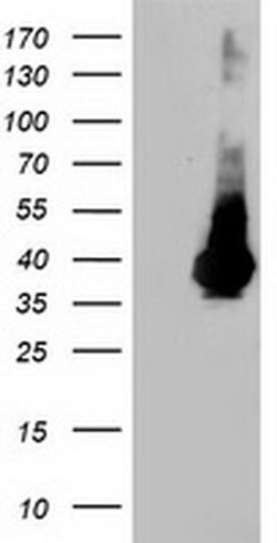 LDLRAP1 Mouse anti-Human, Clone: OTI7E11, liquid, TrueMAB 100 &mu;L; Unconjugated:Antibodies,