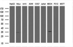 LDLRAP1 Monoclonal Antibody (OTI7A5), TrueMAB , OriGene 100 &mu;L; Unconjugated:Antibodies,