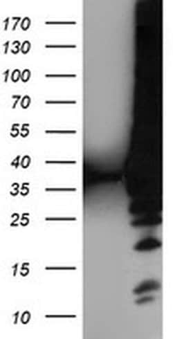LDLRAP1 Monoclonal Antibody (OTI4G5), TrueMAB , OriGene:Antibodies:Primary