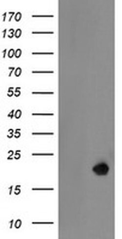 LDOC1 Monoclonal Antibody (OTI1A2), TrueMAB , OriGene 30 &mu;L; Unconjugated:Antibodies,