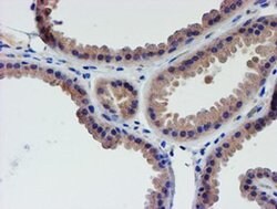 LECT2 Mouse anti-Human, Clone: OTI2A11, liquid, TrueMAB 30 &mu;L; Unconjugated:Antibodies,