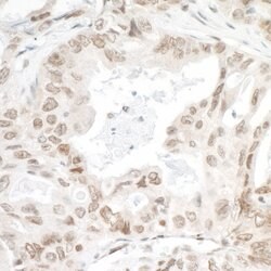 LEDGF/p75 Rabbit anti-Human, Mouse, Polyclonal, Bethyl Laboratories 100