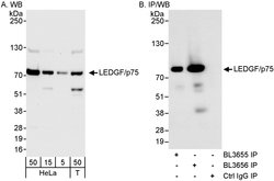 LEDGF/p75 Rabbit anti-Human, Polyclonal, Bethyl Laboratories 100 &mu;L;